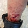 12 Ultra Accident - gash_laceration on back of left leg.jpg